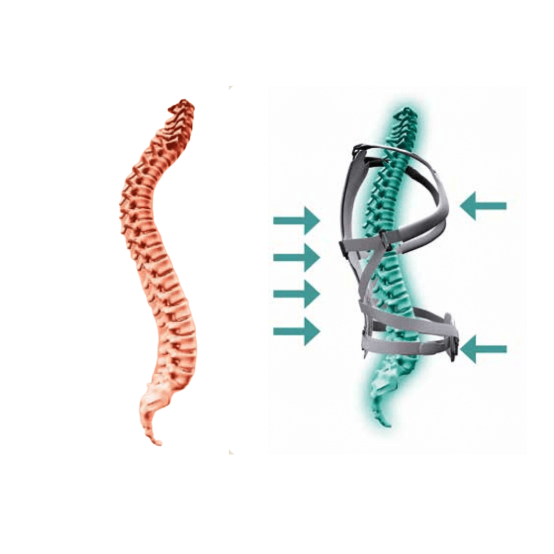 Ro+ten tutore ortopedico eMedicItalia